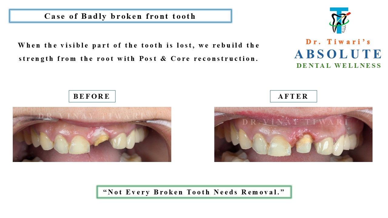 Smile Transformation 3